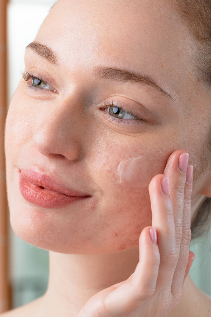 Zinc y niacinamida: la dupla imprescindible para tu piel