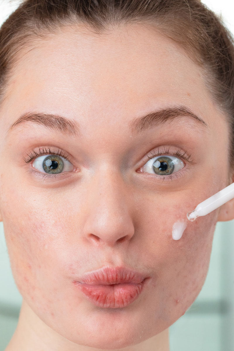 Ácido azelaico: el ingrediente multitasking que tu piel agradecerá