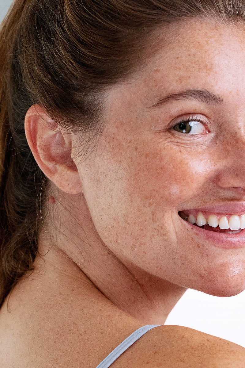 ¿Piel con picor, rojeces y sequedad? Podría ser eczema atópico, y aquí te decimos cuál es tu mejor aliado.