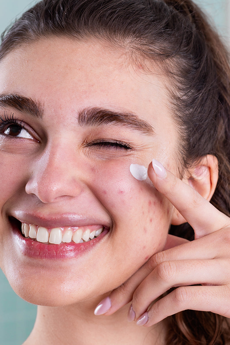 驴C贸mo aliviar la piel irritada? Consejos esenciales para el cuidado diario.