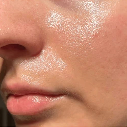 Niacinamida: el ingrediente que tu piel está pidiendo sin saberlo.