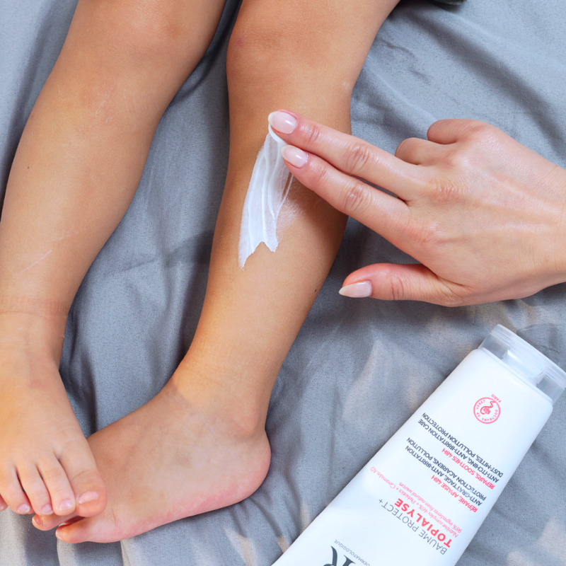 La mano de una mujer aplicando producto en la pierna de un niño del Baume protect+ TOPIALYSE para pieles secas y sensibles