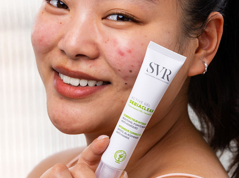 Sebiaclear Active Gel: El aliado real de las pieles mixtas a grasas