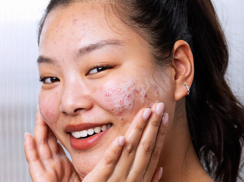 ¿Gel, agua micelar o crema limpiadora? Cómo elegir tu limpiador Sebiaclear