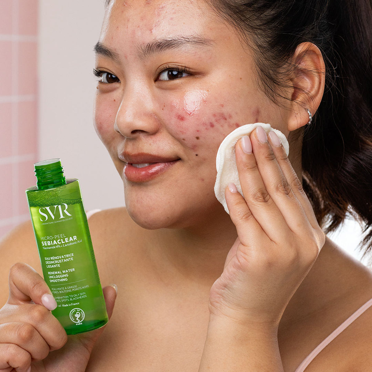 Mujer aplicando tónico exfoliante SVR Sebiaclear Micro-Peel con un disco de algodón sobre su rostro con imperfecciones.